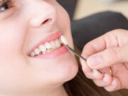 Dental Veneers Require Specific Aftercare Instructions