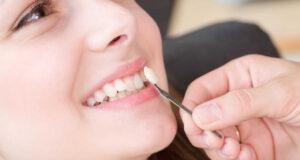 Dental Veneers Require Specific Aftercare Instructions