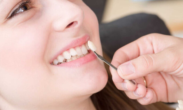 Dental Veneers Require Specific Aftercare Instructions